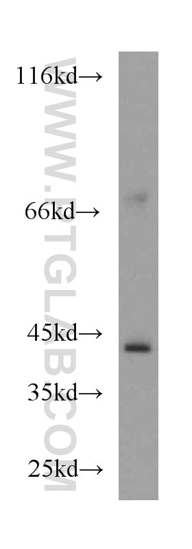 Western Blot (WB) analysis of mouse kidney tissue using PPM1L Polyclonal antibody (18203-1-AP)