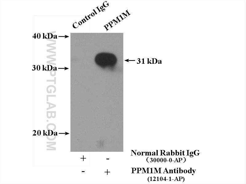 Immunoprecipitation (IP) experiment of mouse lung tissue using PPM1M Polyclonal antibody (12104-1-AP)