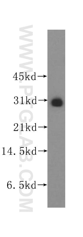 Western Blot (WB) analysis of human lung tissue using PPM1M Polyclonal antibody (12104-1-AP)