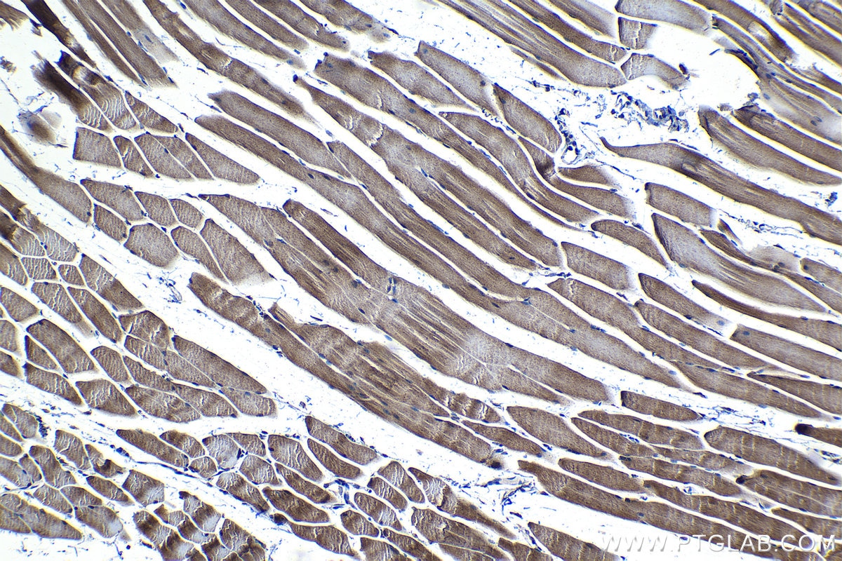Immunohistochemistry (IHC) staining of mouse skeletal muscle tissue using PDP1 Polyclonal antibody (21176-1-AP)