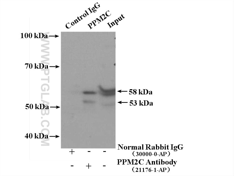Immunoprecipitation (IP) experiment of mouse brain tissue using PDP1 Polyclonal antibody (21176-1-AP)