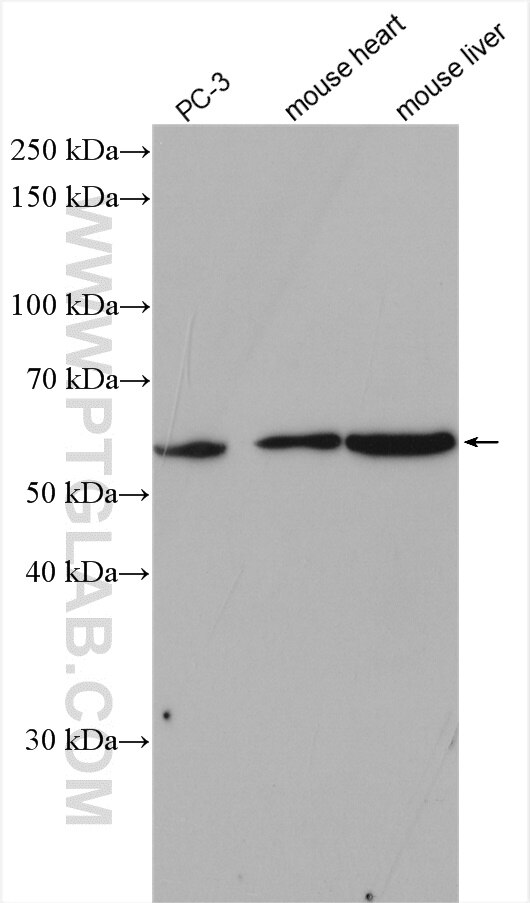 Western Blot (WB) analysis of various lysates using PDP1 Polyclonal antibody (21176-1-AP)