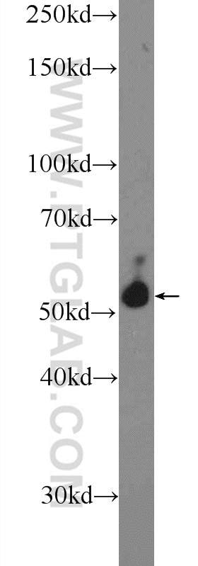 Western Blot (WB) analysis of mouse brain tissue using PDP1 Polyclonal antibody (21176-1-AP)