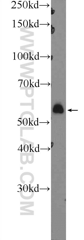 Western Blot (WB) analysis of mouse skeletal muscle tissue using PDP1 Polyclonal antibody (21176-1-AP)