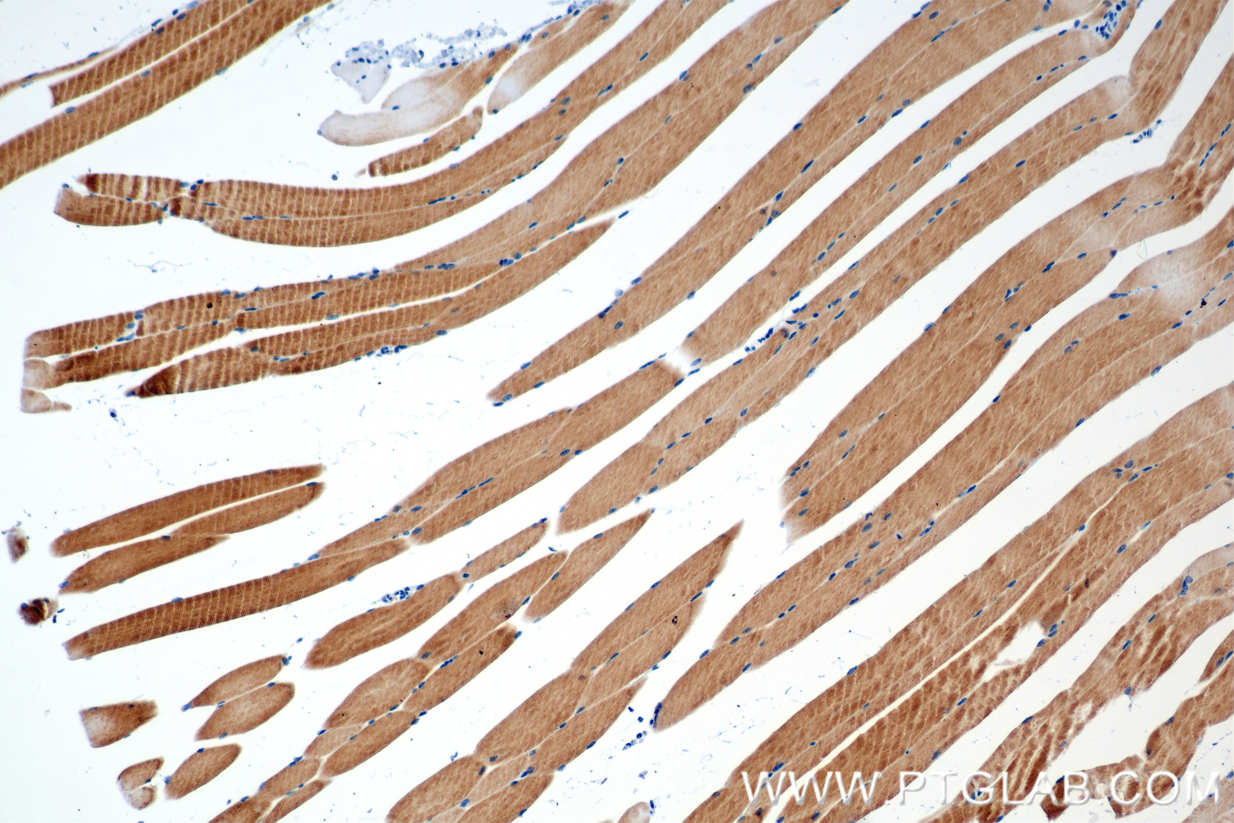Immunohistochemistry (IHC) staining of mouse skeletal muscle tissue using PDP1 Recombinant antibody (84612-3-RR)