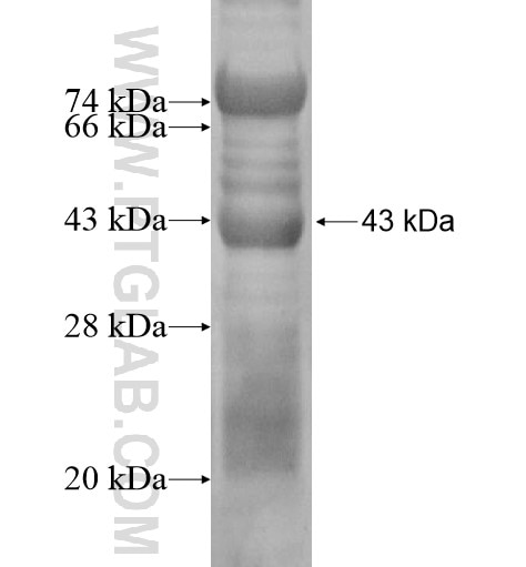 PPM2C fusion protein Ag15453 SDS-PAGE