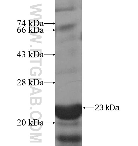 PPM2C fusion protein Ag15550 SDS-PAGE