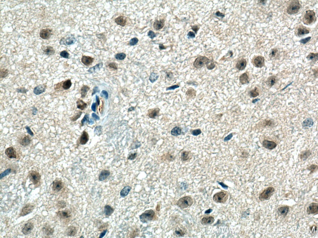 Immunohistochemistry (IHC) staining of mouse brain tissue using PPME1 Polyclonal antibody (14435-1-AP)