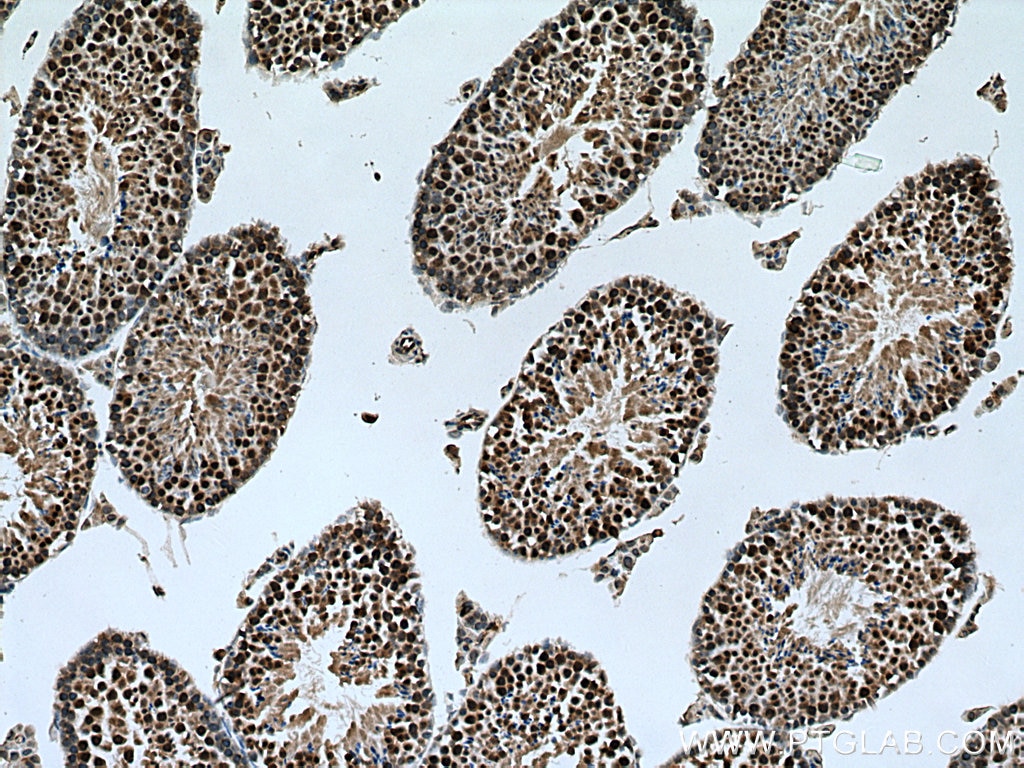 Immunohistochemistry (IHC) staining of mouse testis tissue using PPME1 Polyclonal antibody (14435-1-AP)