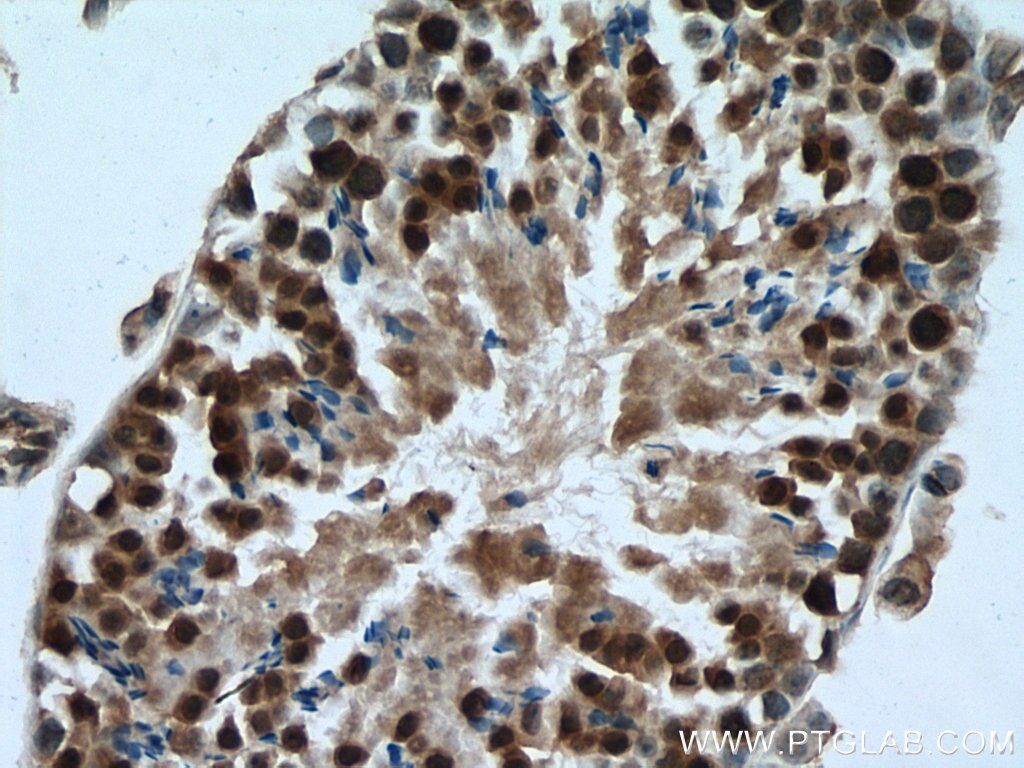 Immunohistochemistry (IHC) staining of mouse testis tissue using PPME1 Polyclonal antibody (14435-1-AP)