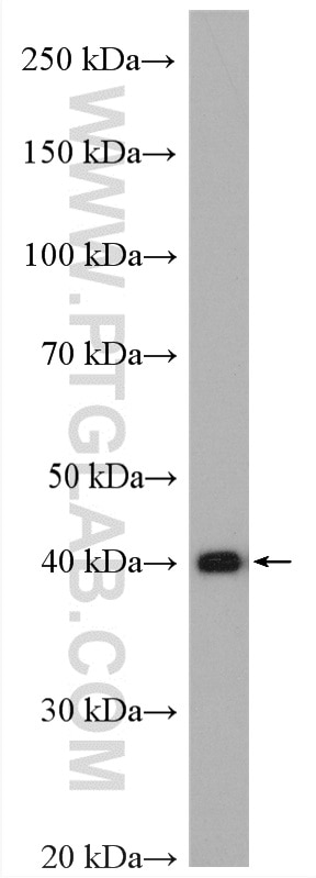 Western Blot (WB) analysis of fetal human brain tissue using PPME1 Polyclonal antibody (14435-1-AP)