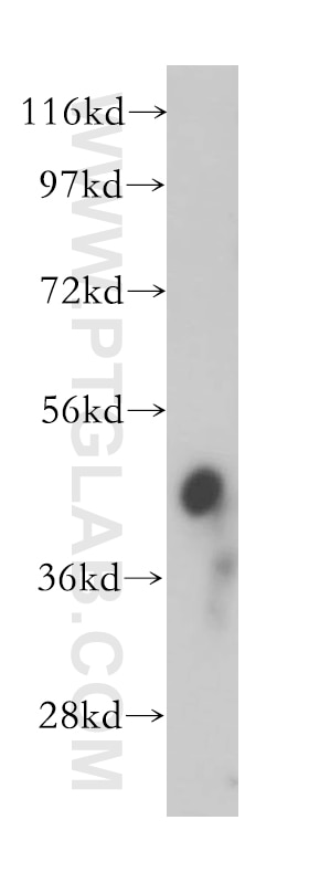 Western Blot (WB) analysis of human brain tissue using PPME1 Polyclonal antibody (14435-1-AP)