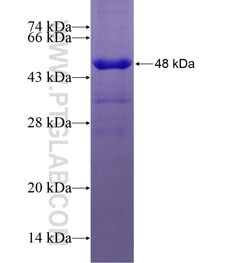 PPME1 fusion protein Ag5869 SDS-PAGE