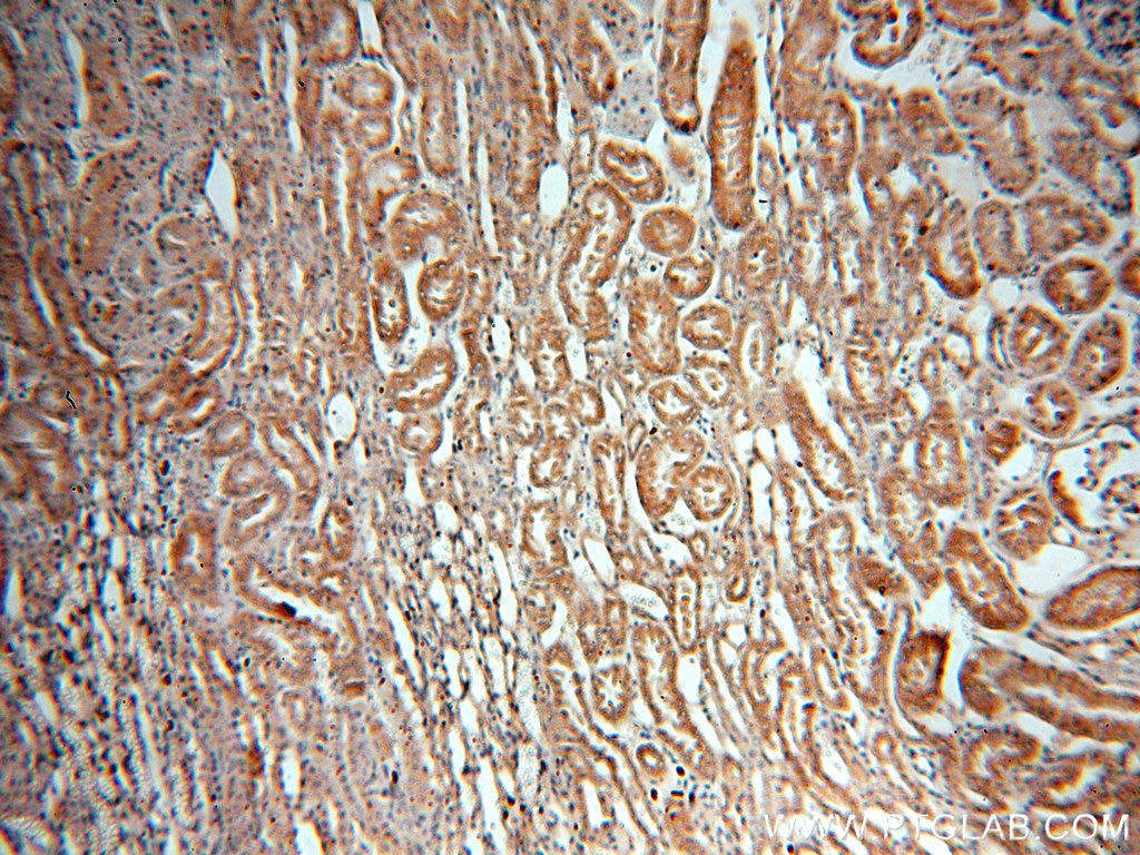 IHC staining of human kidney using 14870-1-AP
