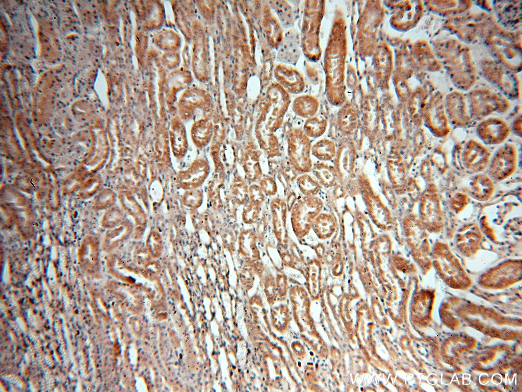 Immunohistochemistry (IHC) staining of human kidney tissue using PPOX Polyclonal antibody (14870-1-AP)