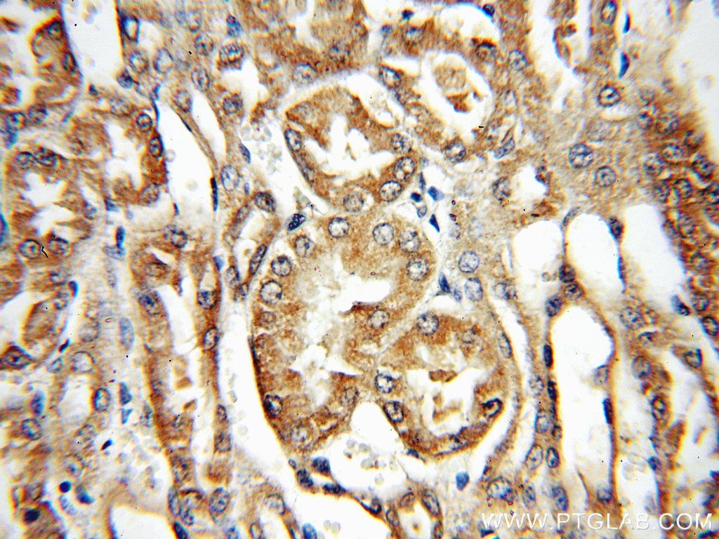 Immunohistochemistry (IHC) staining of human kidney tissue using PPOX Polyclonal antibody (14870-1-AP)