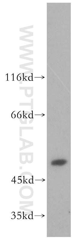 WB analysis of human placenta using 14870-1-AP