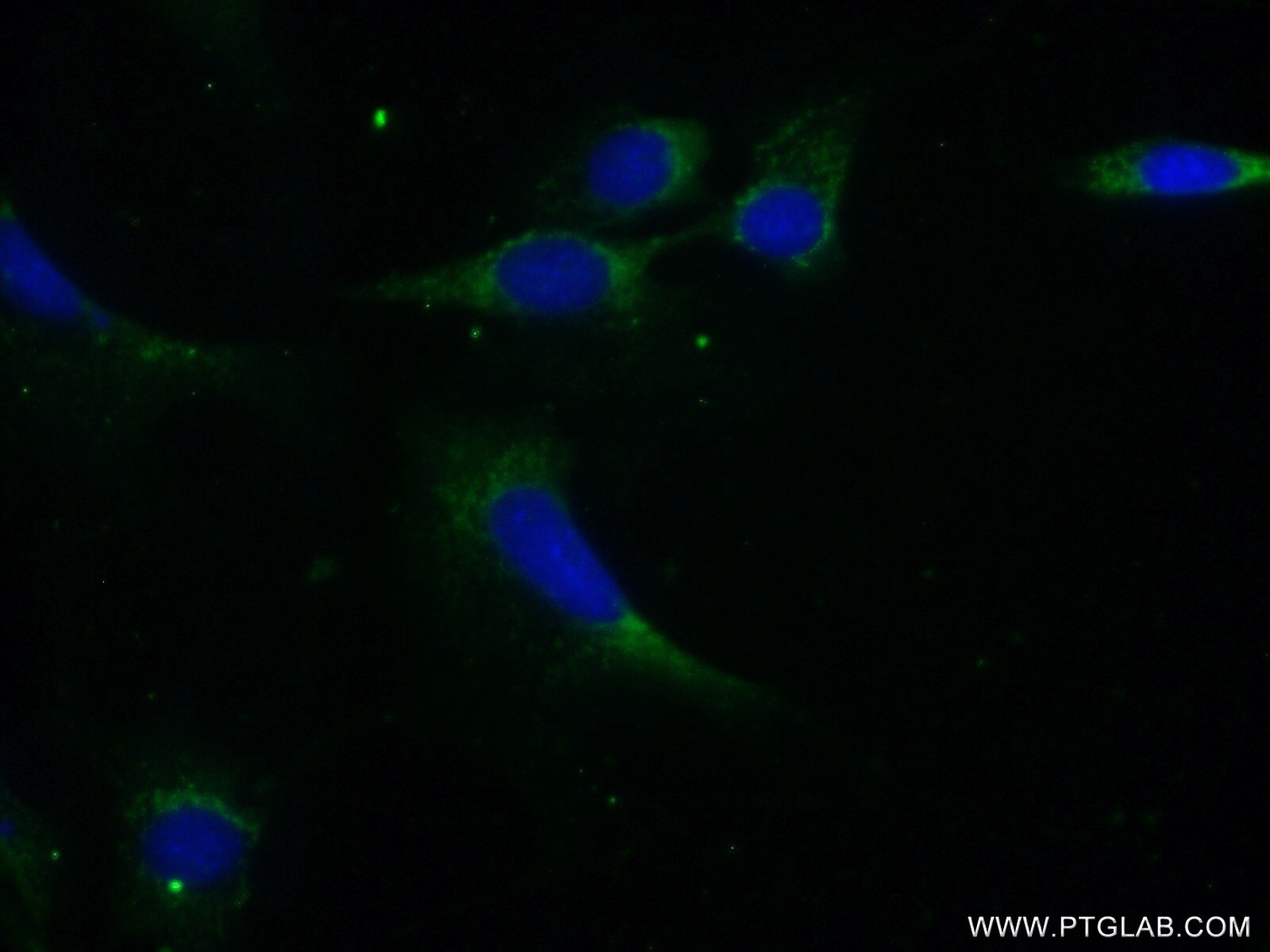 Immunofluorescence (IF) / fluorescent staining of NIH/3T3 cells using PPP1CB Polyclonal antibody (10140-2-AP)