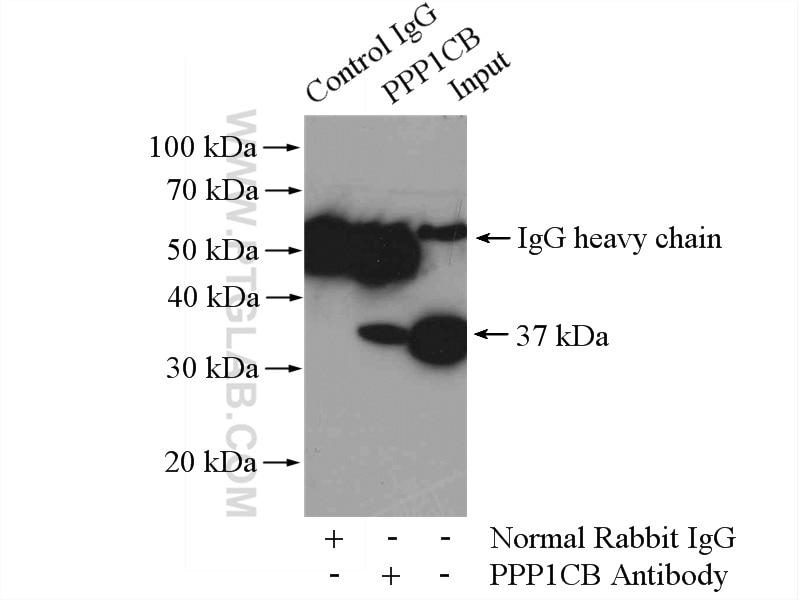 Immunoprecipitation (IP) experiment of mouse brain tissue using PPP1CB-Specific Polyclonal antibody (10140-2-AP)