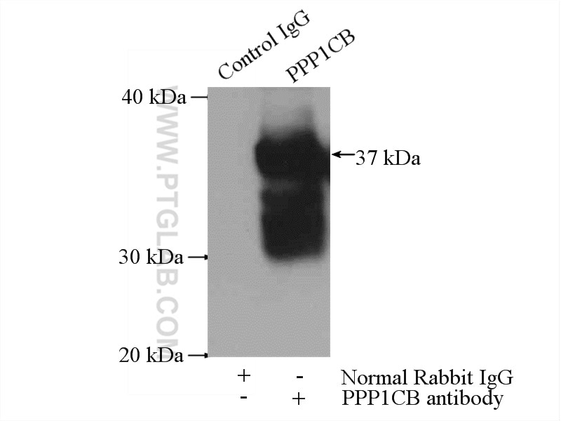 Immunoprecipitation (IP) experiment of mouse brain tissue using PPP1CB-Specific Polyclonal antibody (10140-2-AP)