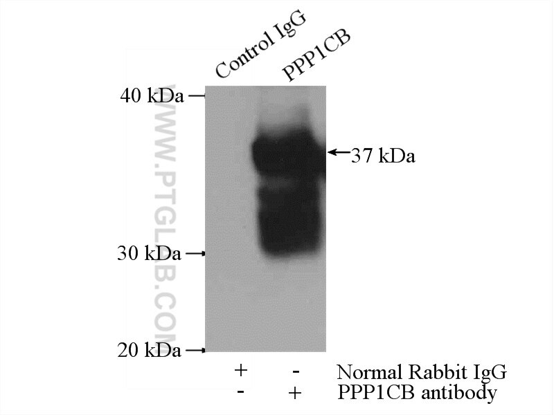 IP experiment of mouse brain using 10140-2-AP