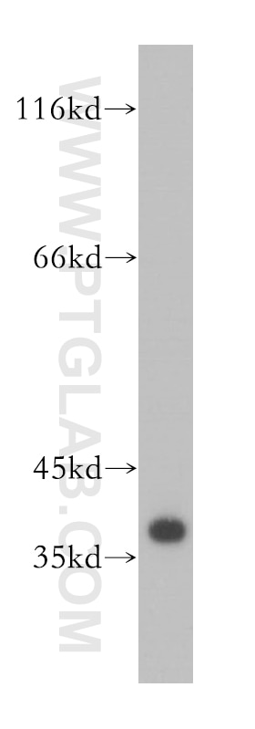 Western Blot (WB) analysis of human brain tissue using PPP1CB-Specific Polyclonal antibody (10140-2-AP)