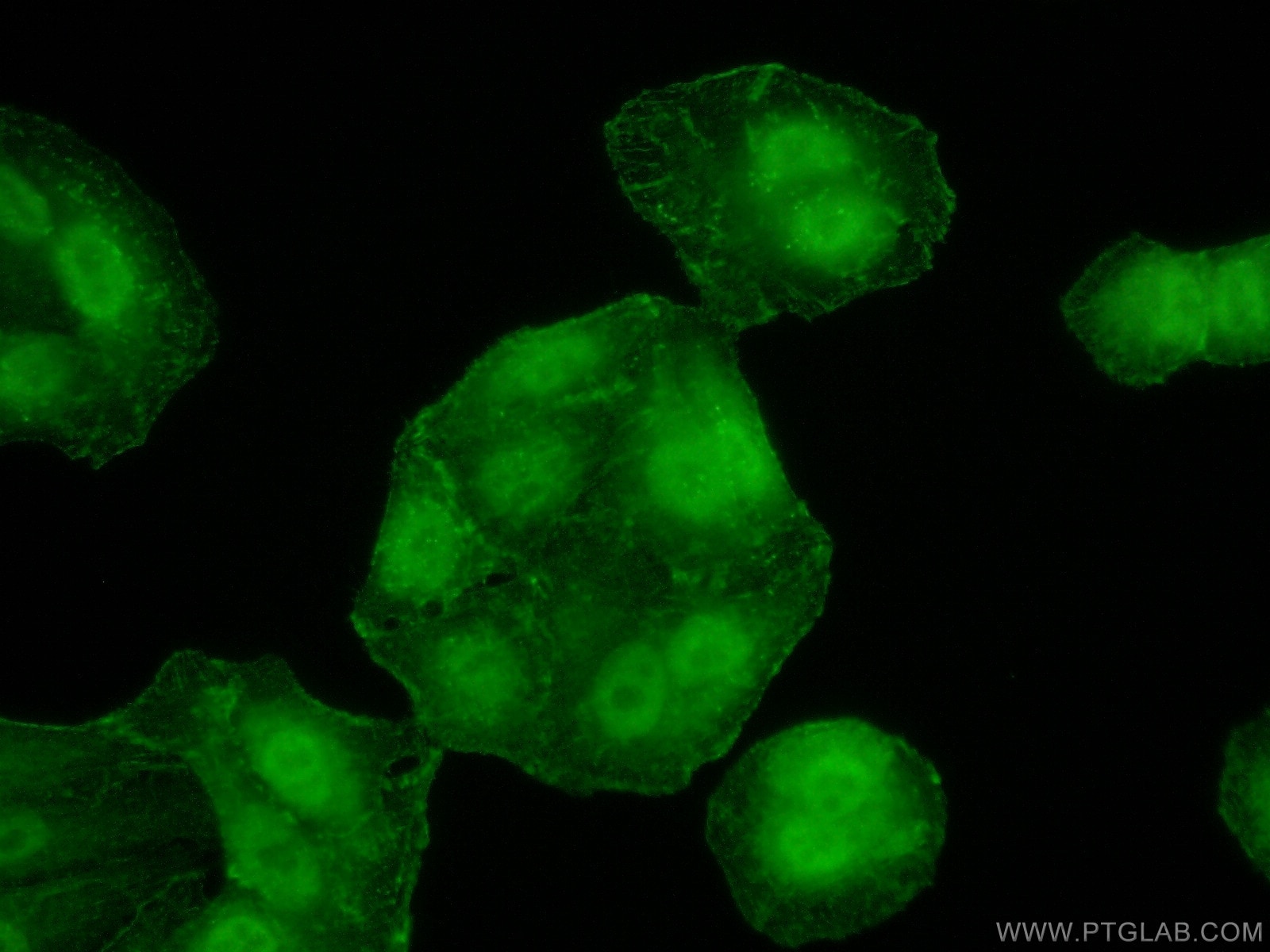 Immunofluorescence (IF) / fluorescent staining of A549 cells using PPP1CB-Specific Polyclonal antibody (55136-1-AP)