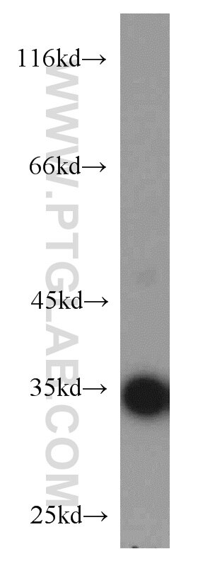PPP1CB-Specific