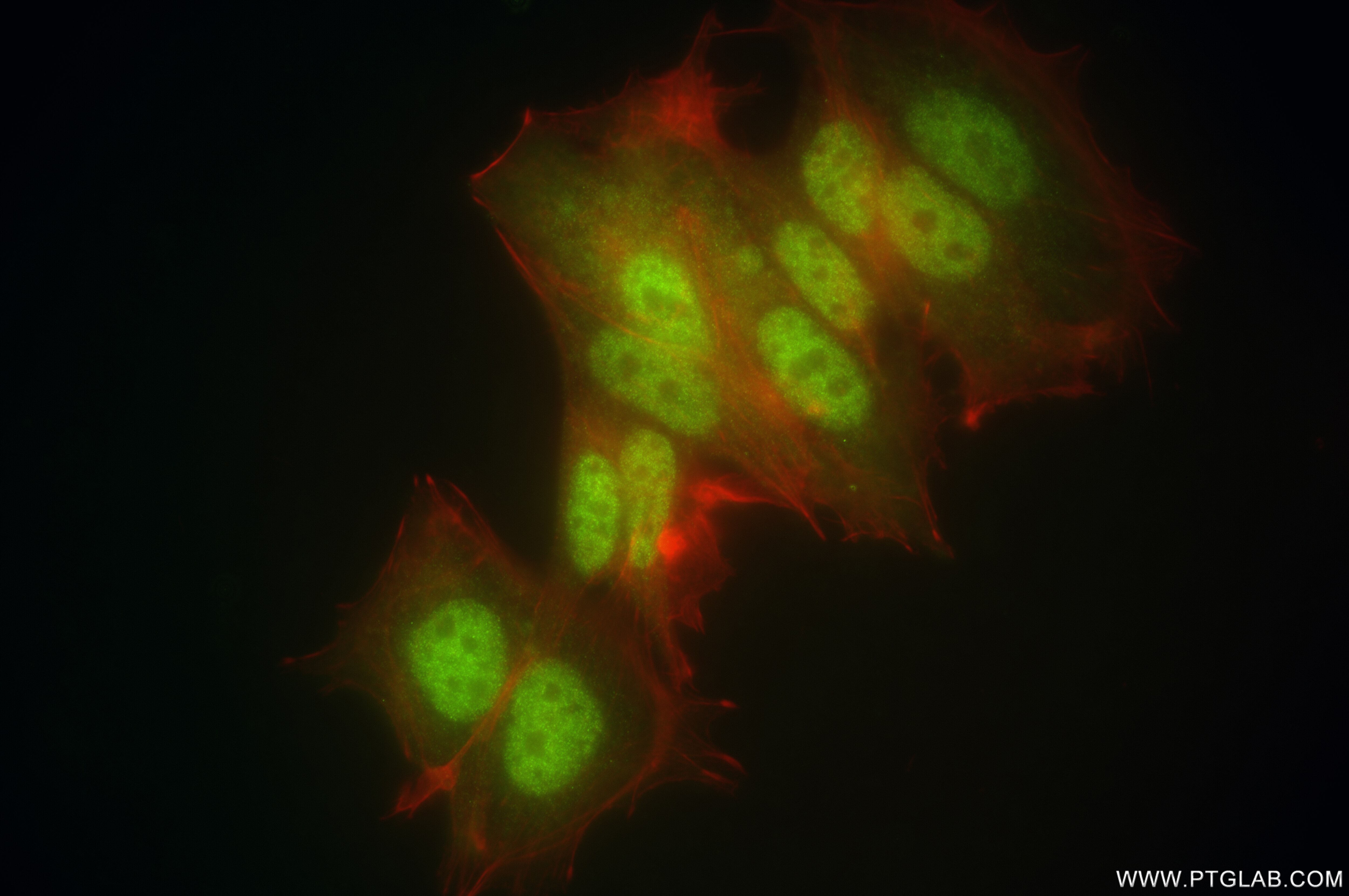 Immunofluorescence (IF) / fluorescent staining of MCF-7 cells using PPP1CB Recombinant antibody (84938-5-RR)
