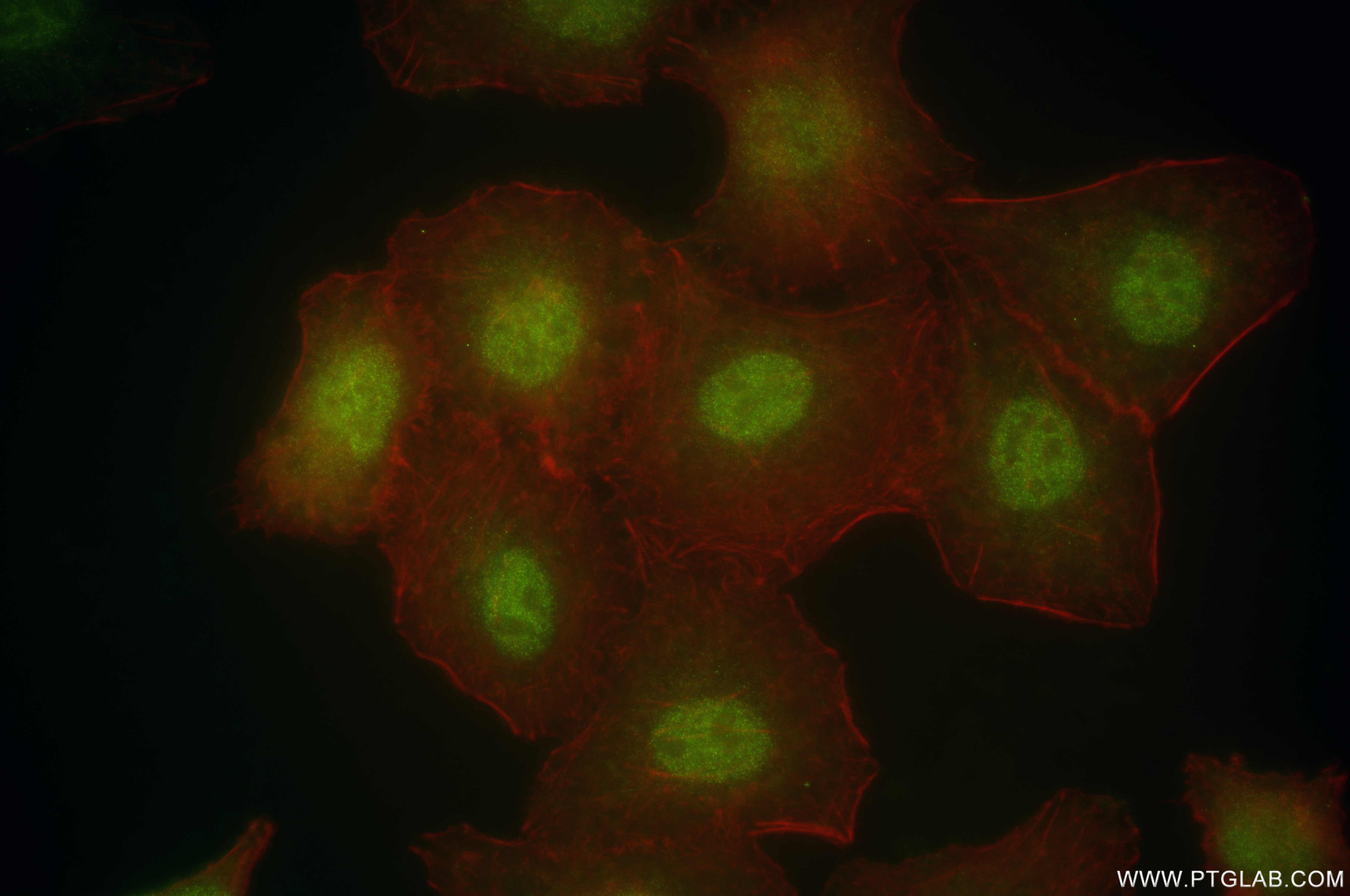Immunofluorescence (IF) / fluorescent staining of A549 cells using PPP1CB Recombinant antibody (84938-5-RR)