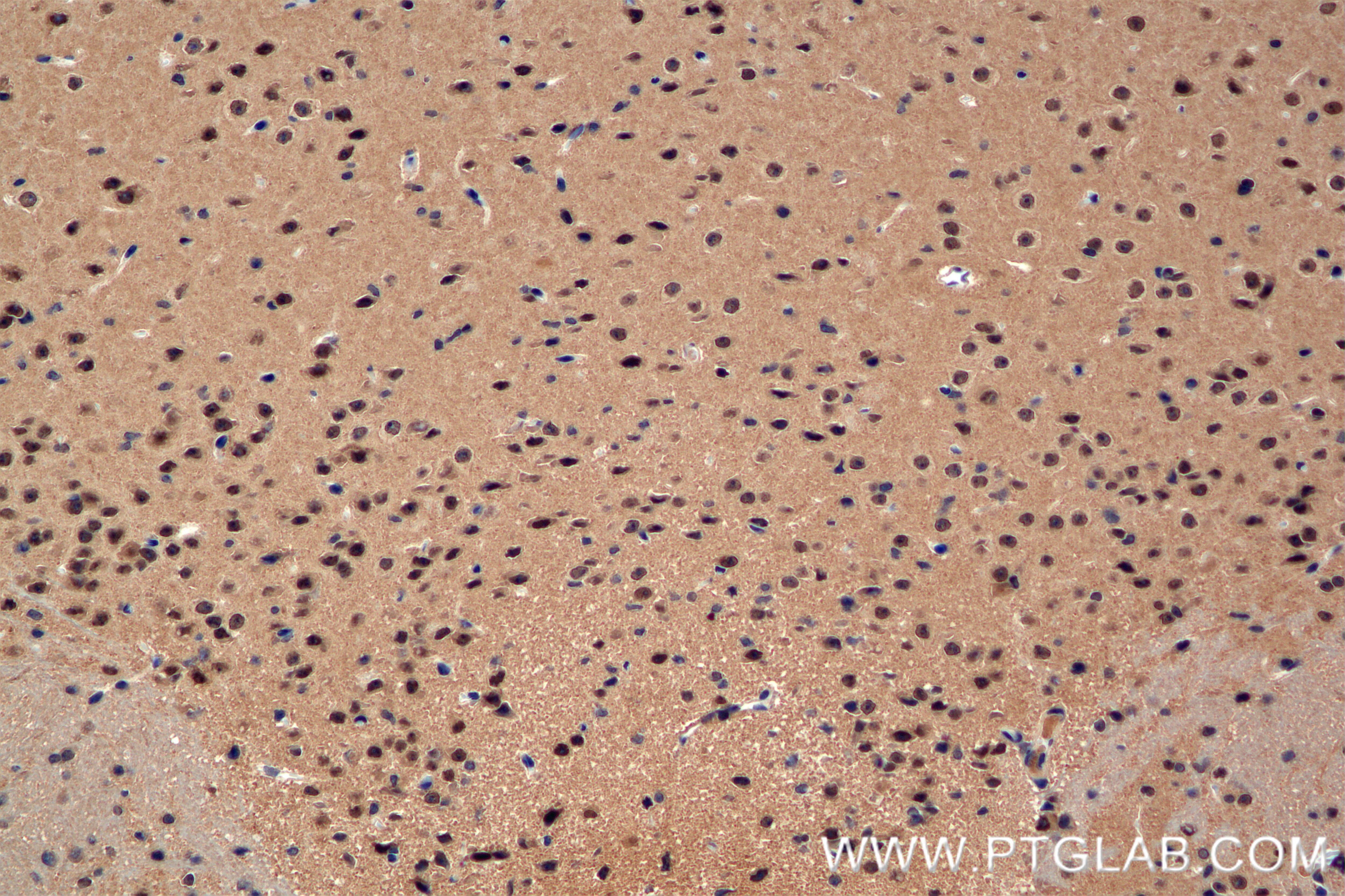 Immunohistochemistry (IHC) staining of mouse brain tissue using PPP1CB Recombinant antibody (84938-5-RR)