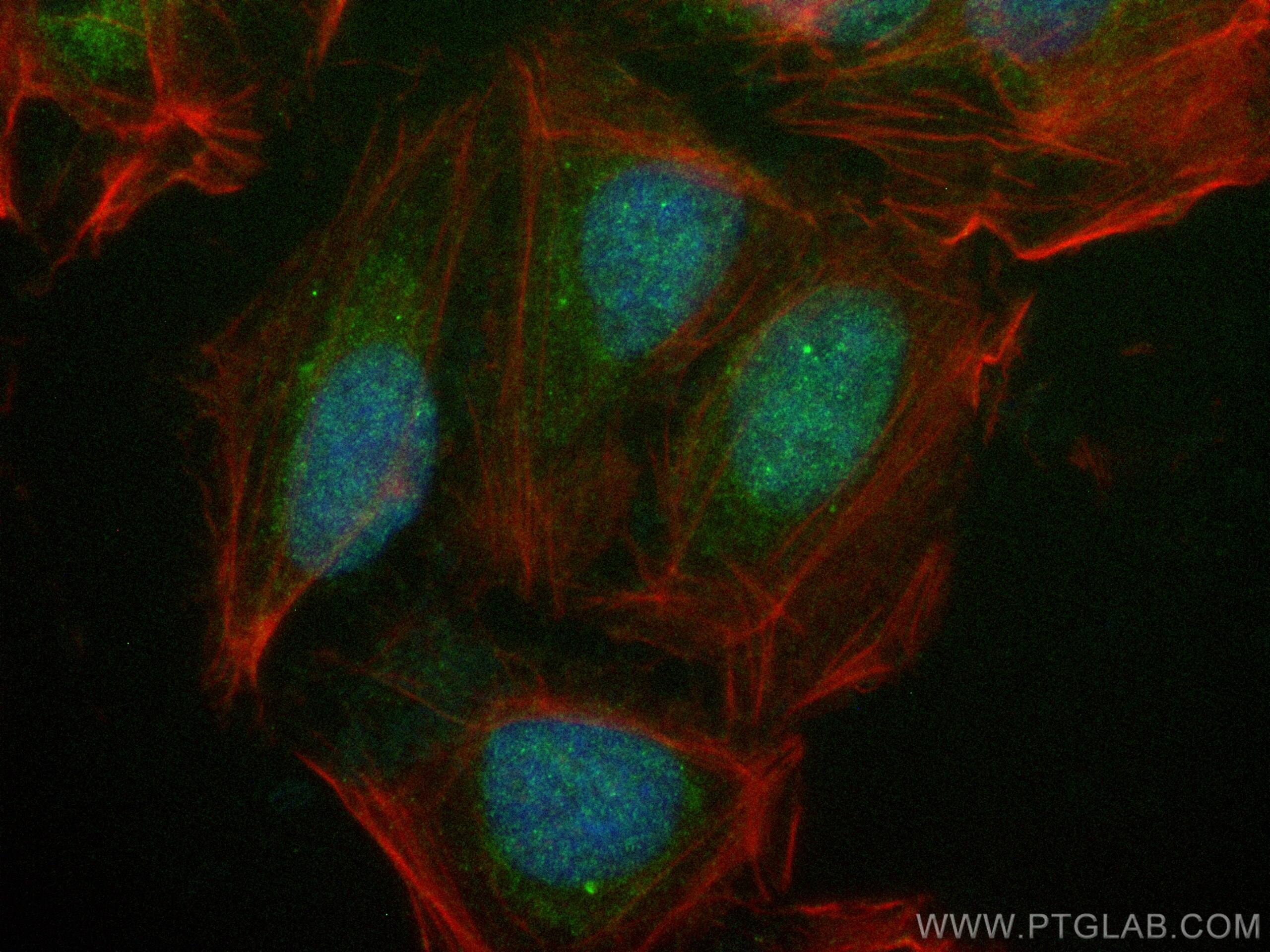PPP1CB-Specific
