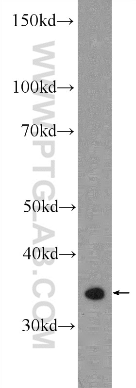 WB analysis of HEK-293T using 11082-1-AP