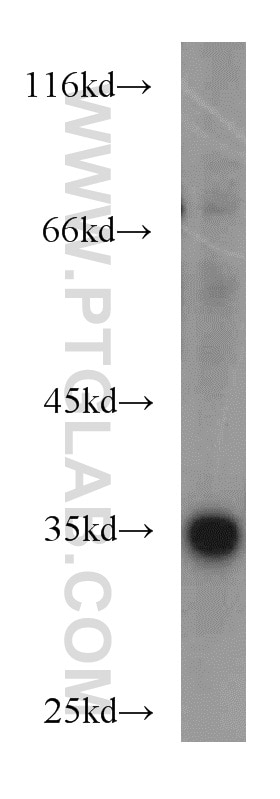 Western Blot (WB) analysis of MCF-7 cells using PPP1CC Polyclonal antibody (11082-1-AP)