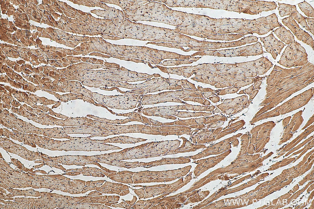 Immunohistochemistry (IHC) staining of mouse heart tissue using PPP1CC Polyclonal antibody (30070-1-AP)