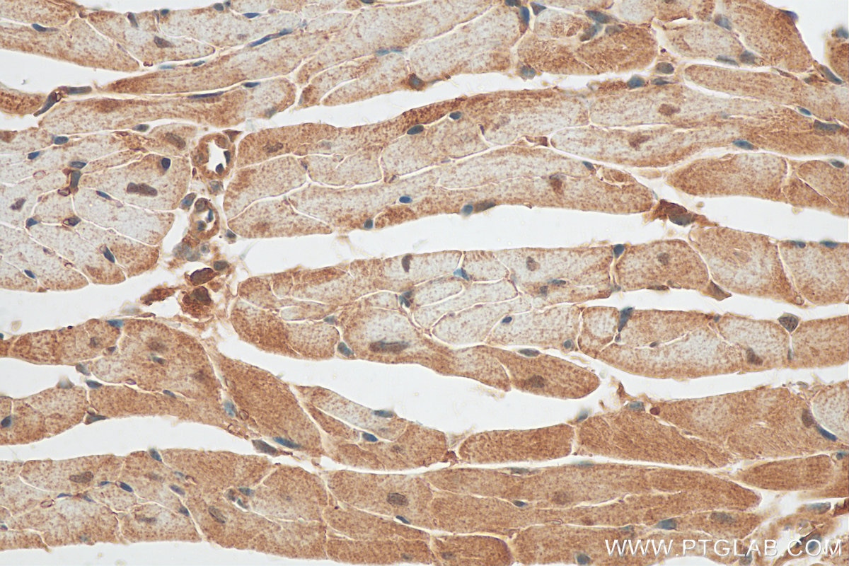 Immunohistochemistry (IHC) staining of mouse heart tissue using PPP1CC Polyclonal antibody (30070-1-AP)