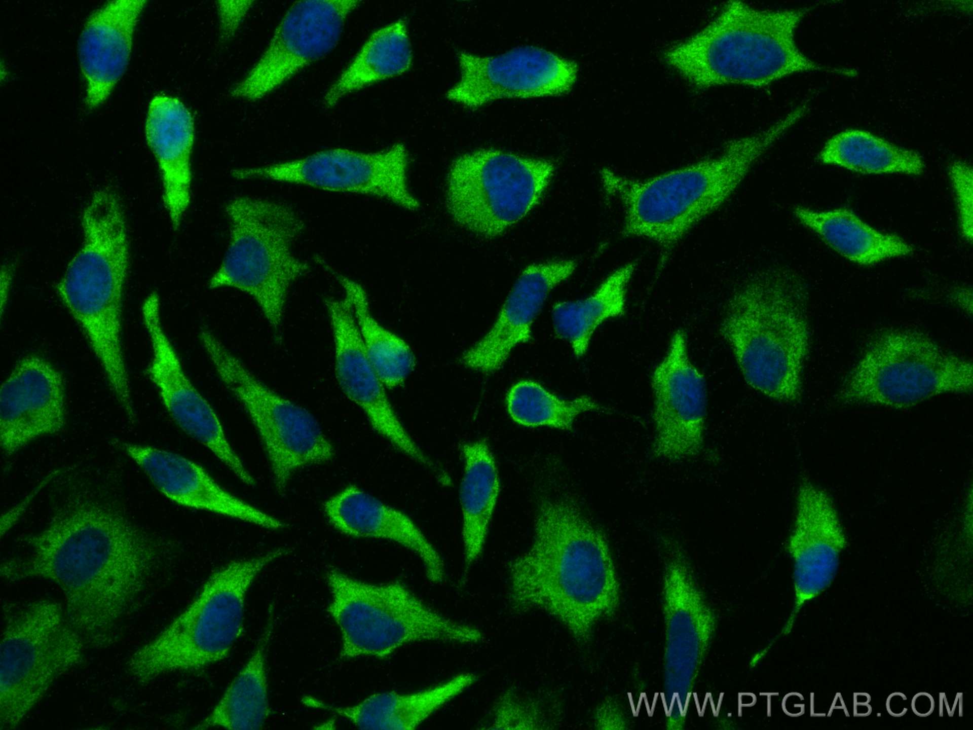 Immunofluorescence (IF) / fluorescent staining of HeLa cells using PPP1CC Polyclonal antibody (55150-1-AP)