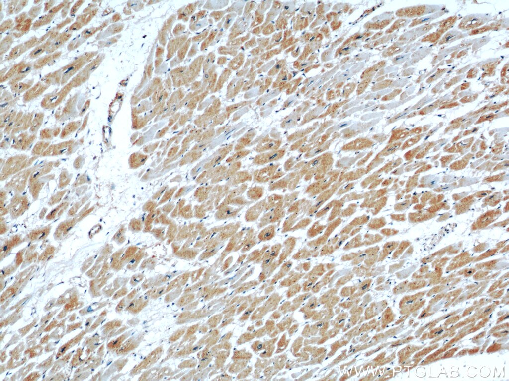 Immunohistochemistry (IHC) staining of human heart tissue using PPP1CC Polyclonal antibody (55150-1-AP)