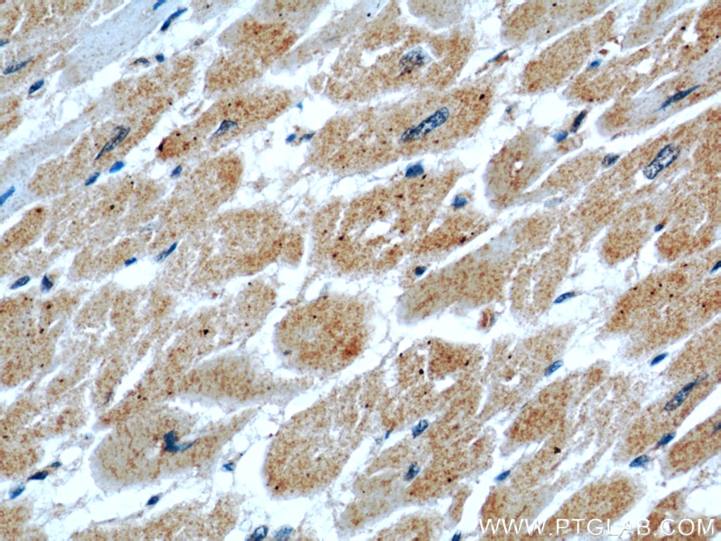 Immunohistochemistry (IHC) staining of human heart tissue using PPP1CC Polyclonal antibody (55150-1-AP)