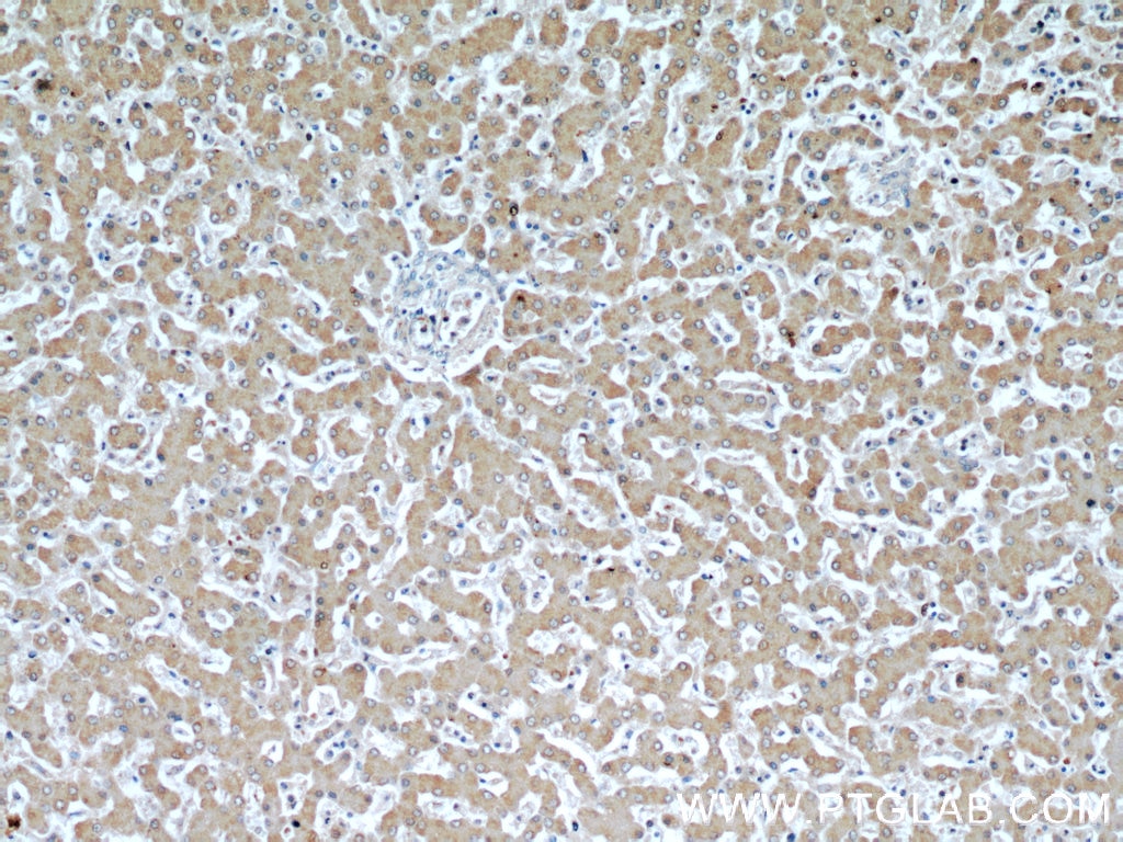 Immunohistochemistry (IHC) staining of human liver tissue using PPP1CC Polyclonal antibody (55150-1-AP)