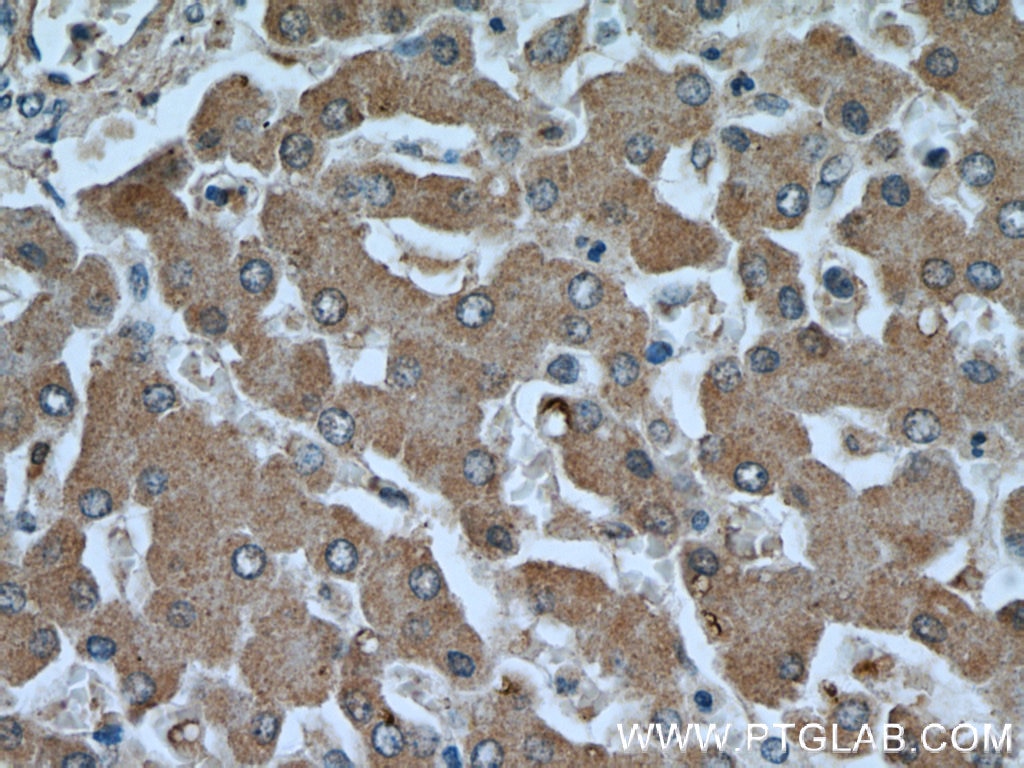 Immunohistochemistry (IHC) staining of human liver tissue using PPP1CC Polyclonal antibody (55150-1-AP)