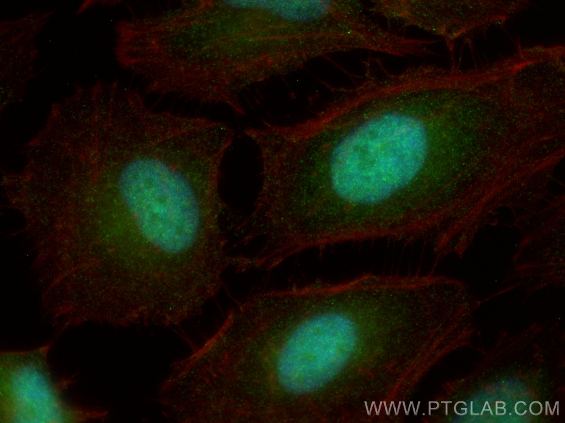 Immunofluorescence (IF) / fluorescent staining of HeLa cells using PPP1CC Monoclonal antibody (68122-1-Ig)