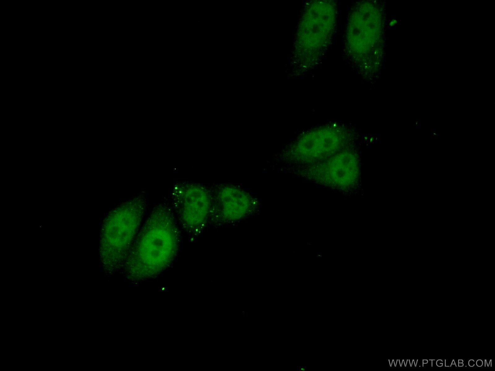 Immunofluorescence (IF) / fluorescent staining of HepG2 cells using PPP1R10 Polyclonal antibody (24450-1-AP)