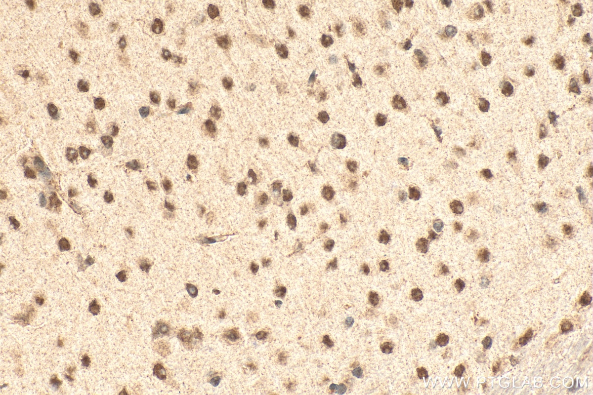 Immunohistochemistry (IHC) staining of mouse brain tissue using PPP1R10 Polyclonal antibody (24450-1-AP)