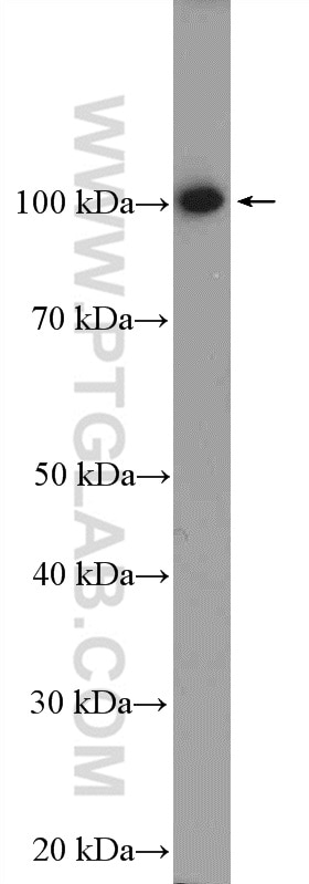 Western Blot (WB) analysis of HepG2 cells using PPP1R10 Polyclonal antibody (24450-1-AP)