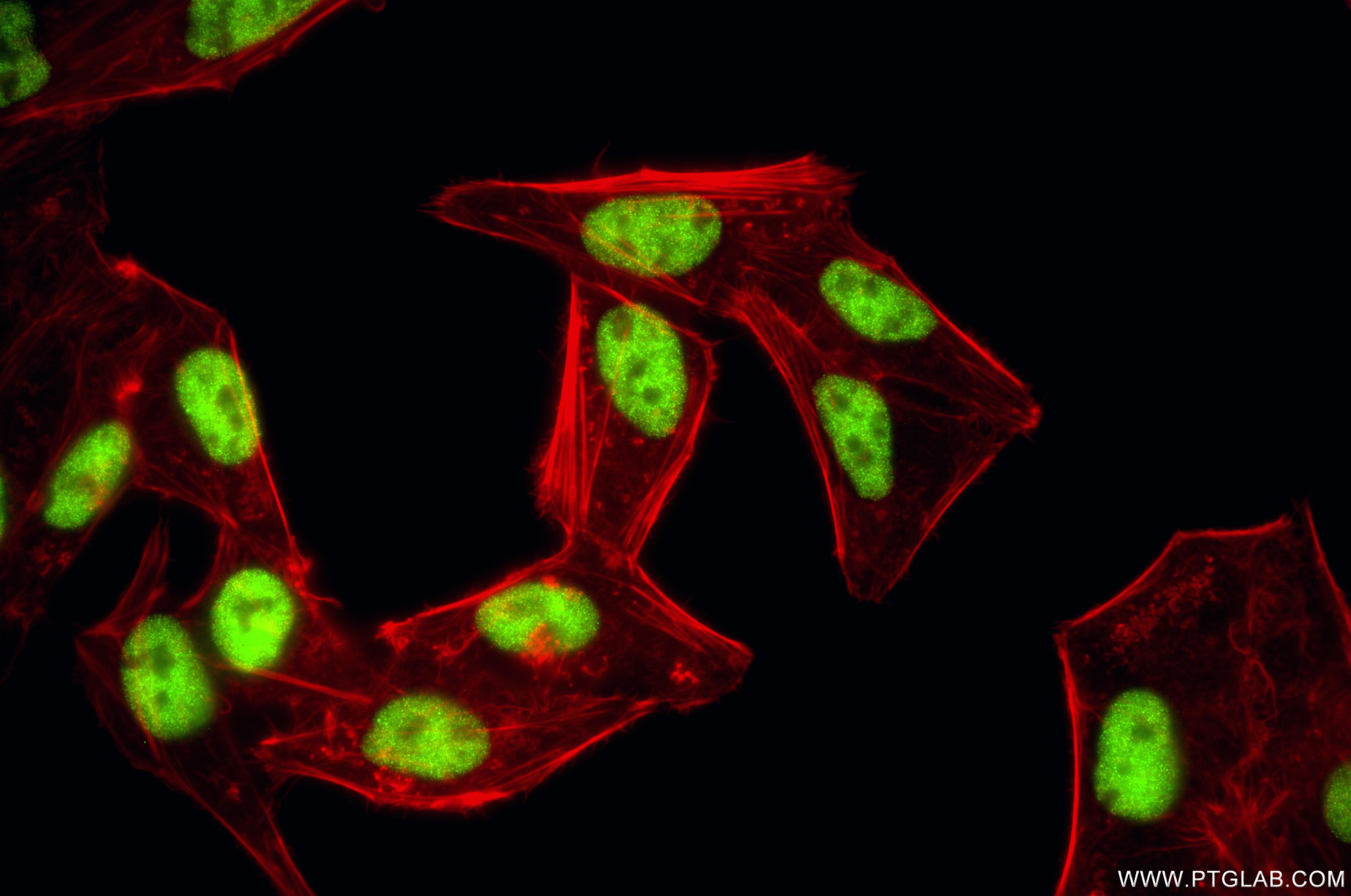 Immunofluorescent analysis of (4% PFA) fixed HepG2 cells using PPP1R10 antibody (86888-1-RR, Clone: 251508G3 ) at dilution of 1:1000 and CoraLite®488-Conjugated Goat Anti-Rabbit IgG(H+L) (SA00013-2), CL594-Phalloidin (red). Immunofluorescence (IF) / fluorescent staining of HepG2 cells using PPP1R10 Recombinant monoclonal antibody (86888-1-RR)
