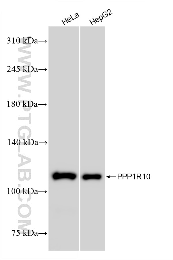 Various lysates were subjected to SDS PAGE followed by western blot with 86888-1-RR (PPP1R10 antibody) at dilution of 1:10000 incubated at room temperature for 1.5 hours. Western Blot (WB) analysis of various lysates using PPP1R10 Recombinant monoclonal antibody (86888-1-RR)