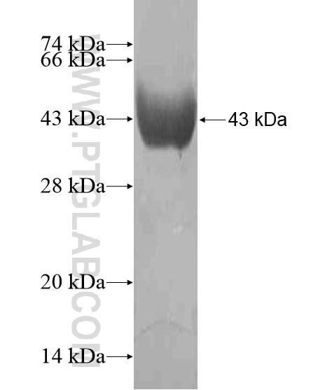 PPP1R10 fusion protein Ag20145 SDS-PAGE