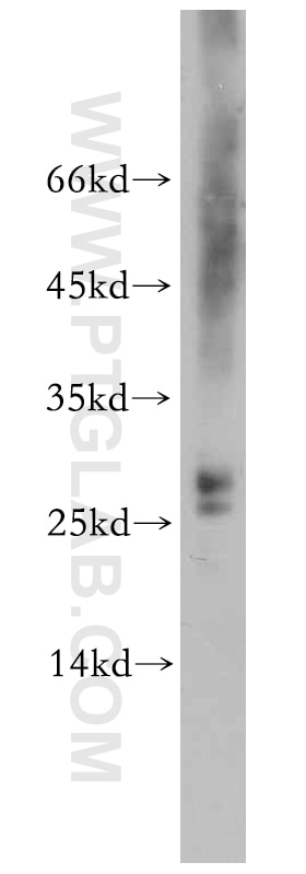 Western Blot (WB) analysis of mouse liver tissue using PPP1R11-Specific Polyclonal antibody (20263-1-AP)