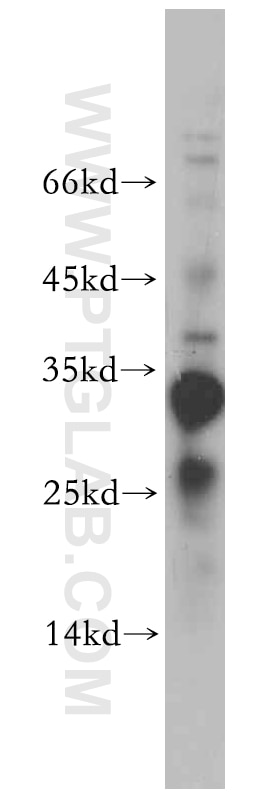 Western Blot (WB) analysis of A431 cells using PPP1R11-Specific Polyclonal antibody (20263-1-AP)